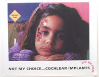 NOT MY CHOICE ... COCHLEAR IMPLANTS