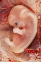 Embryo